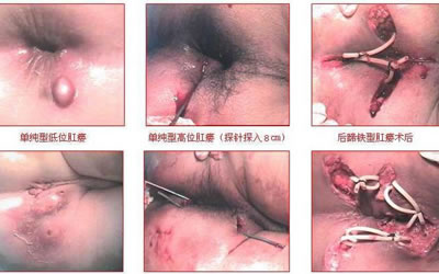 ETM5_]%}2{V(DW%VG[77X6C.jpg