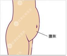 u=371280434,3329726342&fm=52&gp=0.jpg