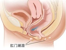 肛门潮湿3.jpg