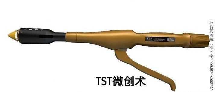 TST微创术.jpg