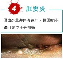 肛窦炎出血.jpg