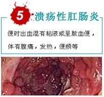 崩溃性肛肠炎出血.jpg