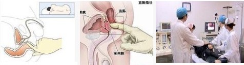 肛裂检查.jpg