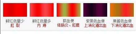 大便出血