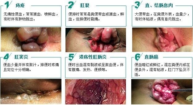QQ图片20150320093130.jpg