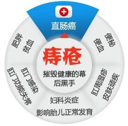女性痔疮.jpg
